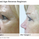 profiles-by-alisa age reverse skin care regimen